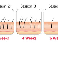 At Home Laser Hair Removal Permanent Hair Removal Device