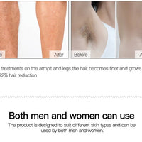 At Home Laser Hair Removal Permanent Hair Removal Device