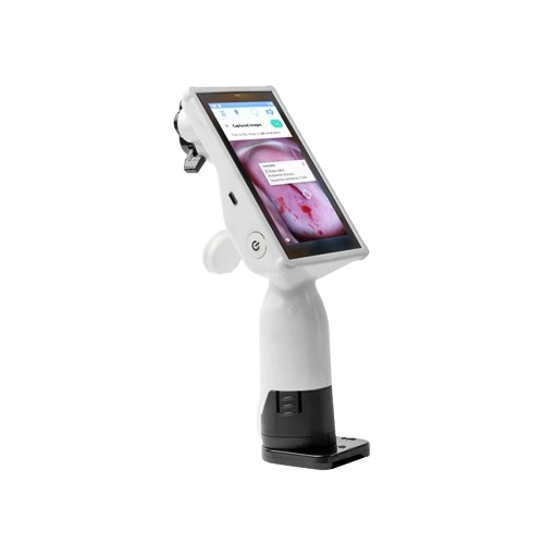 Enhanced Diagnosis: Handheld Big Screen Gynecological Colposcopy Video Colposcope | Your Trusted Medical Tool