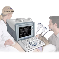 Portable ultrasound scanner for human being I laptop black/white ultrasound Machine
