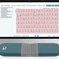 AI ECG Monitor I Holter Monitor 24 Hours | Wireless EKG