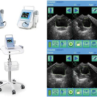 Bladder Volume Tester I BVT01 - bladder scan