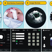 Bladder Volume Tester I Bladder Scan I MD-6000 - bladder