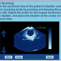 Bladder Volume Tester I Bladder Scan I MD-6000 - bladder