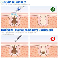 Blackhead Remover Pore Vacuum Upgraded Facial Cleaner Electric Acne Comedone Whitehead Extractor Tool-5 Suction Power 5 Probes Kit