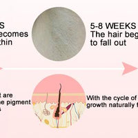 At-Home Hair Removal for Women & Men, Upgraded to 999,999 Flashes Laser Hair Removal, Permanent Painless Hair Removal Device for Facial Whole Body