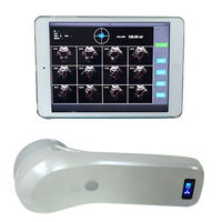 4D Wireless Bladder Scanner Bladder ultrasound