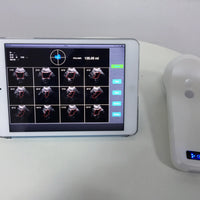 4D Wireless Bladder Scanner Bladder ultrasound