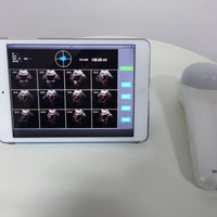 4D Wireless Bladder Scanner Bladder ultrasound