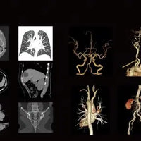 32 Slice CT Scanner – Advanced Medical Computed Tomography Machine for Precise Imaging