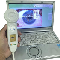 USB iridology Camera for pc with Spanish and English